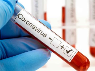 REGISTRA LAREDO, TEXAS MÁS DE 13 MIL CASOS DE COVID EN ENERO